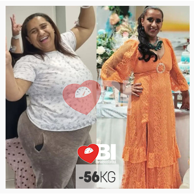 gastric sleeve turkey before and after